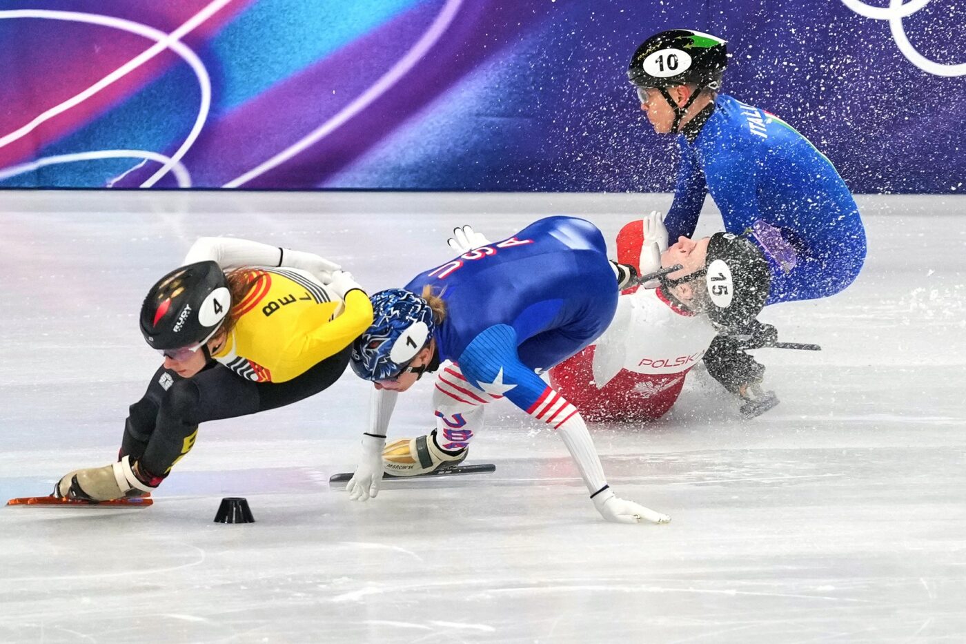 JO CORTINA MILANO 2026 Desfigurată la Jocurile Olimpice, sportiva și-a acoperit jumătate din față în primele poze publicate după operație