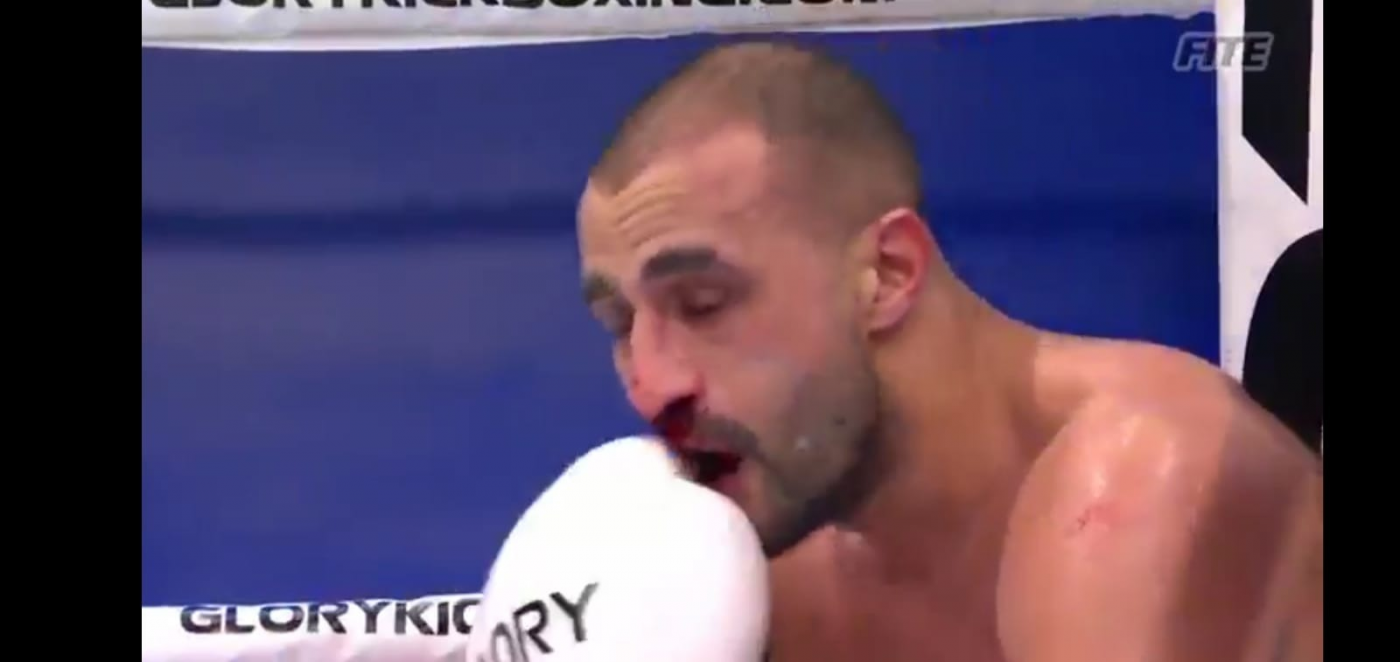 Doamne, Dumnezeule! Badr Hari, umplut de sânge de Benny Adegbuyi! L-a făcut K.O: cum arăta marocanul după ce a fost lovit de român cu bestialitate! FOTO