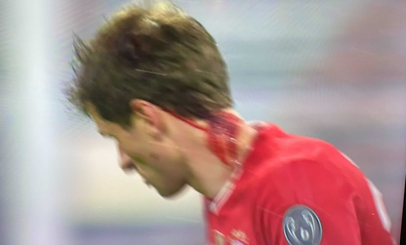Thomas Muller, imagini horror în nebunia cu PSG! Atacantul lui Bayern, plin de sânge după golul 48 în Liga Campionilor. Ce s-a întâmplat | FOTO