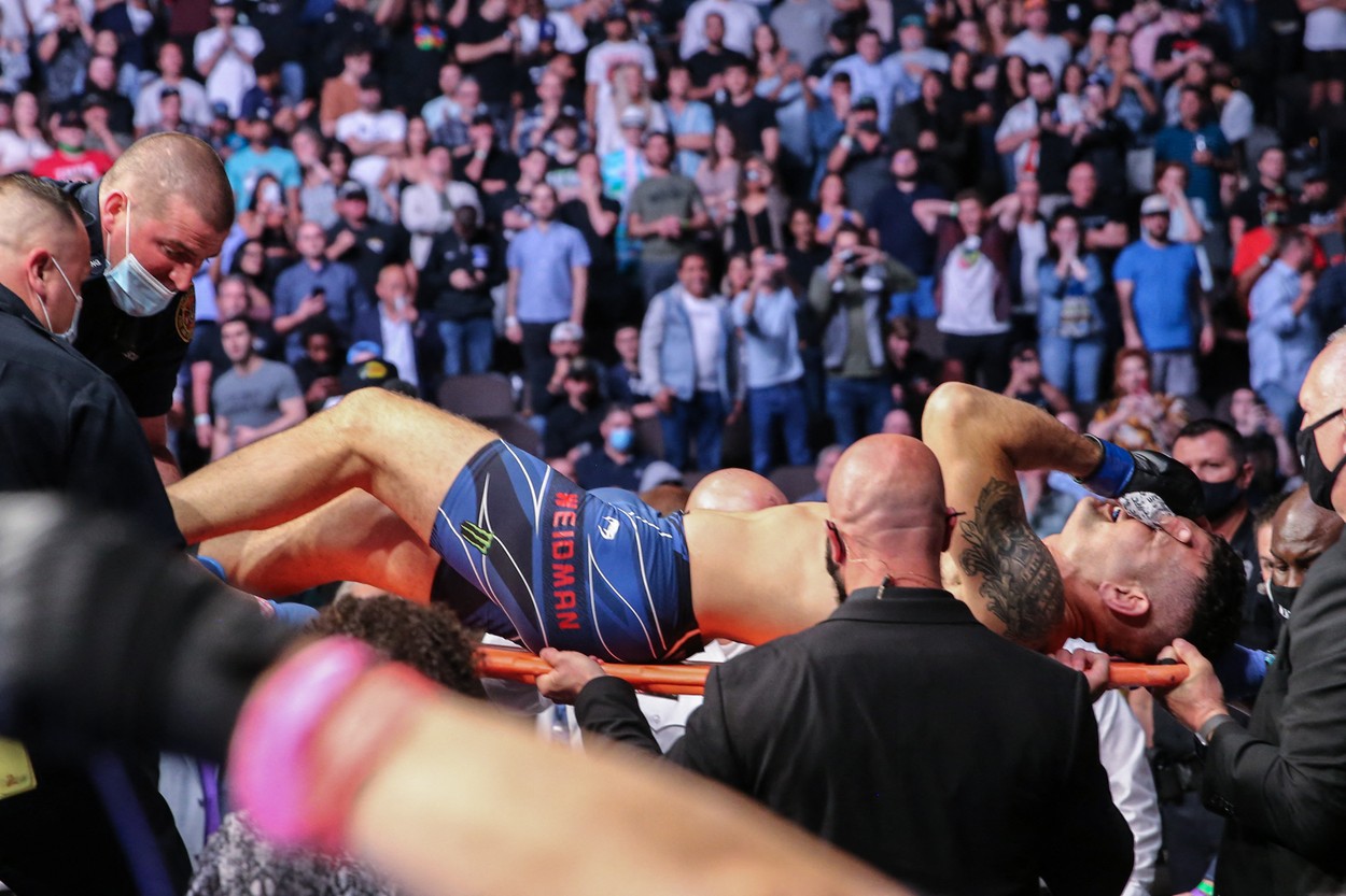 Fostul campion Chris Weidman a fost supus unei operații, după ce a suferit o fractură îngrozitoare la picior după doar 17 secunde de luptă!