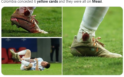 A jucat cu glezna îmbibată cu sânge! Faza de la Copa America din Brazilia care putea să-i rupă piciorul lui Lionel Messi. Reacții dure pe Twitter | VIDEO