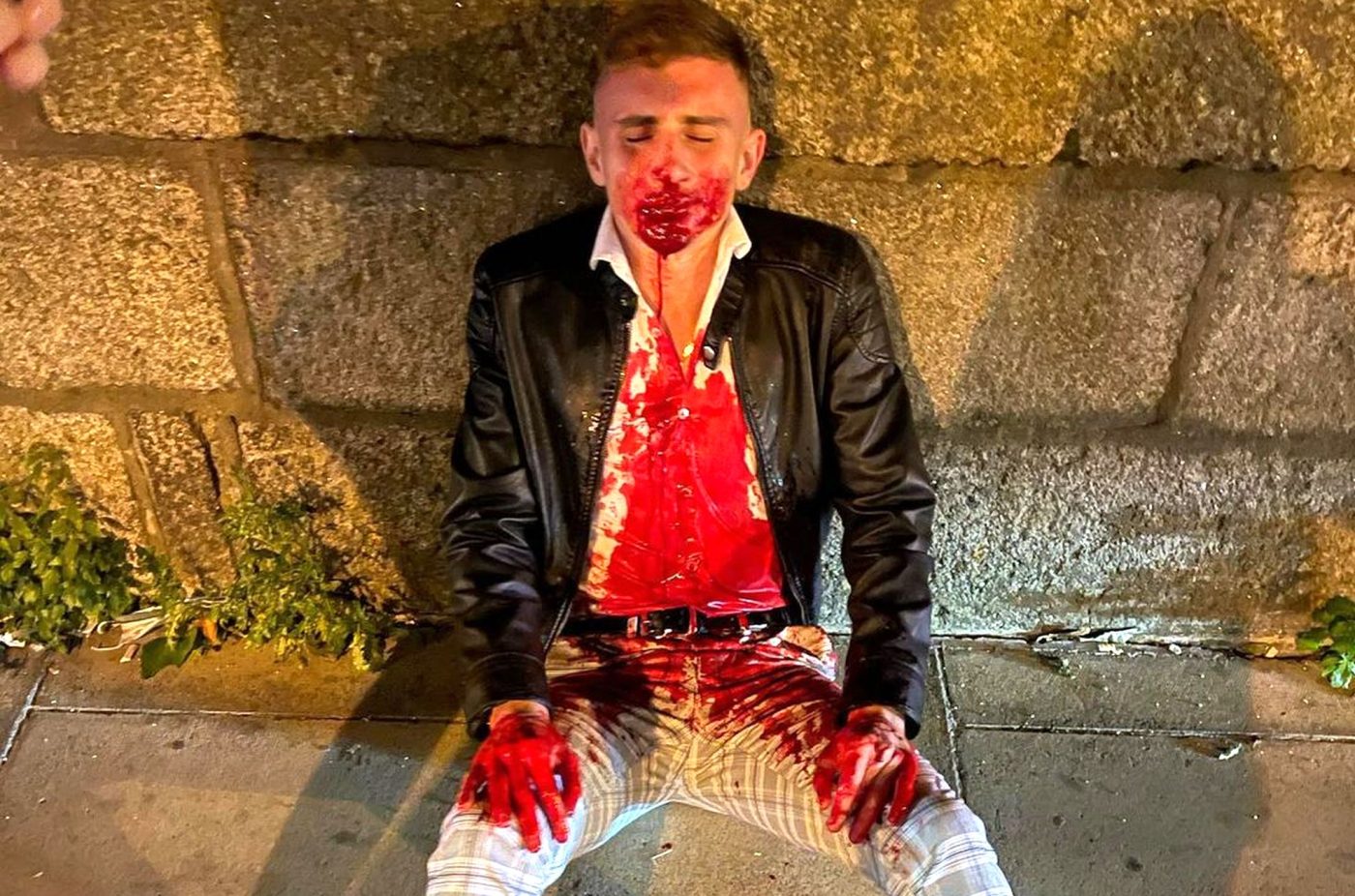 De la Jocurile Olimpice, direct la spital! Un luptător de taekwondo, desfigurat pe stradă și lăsat într-o baltă de sânge! Imagini șocante!