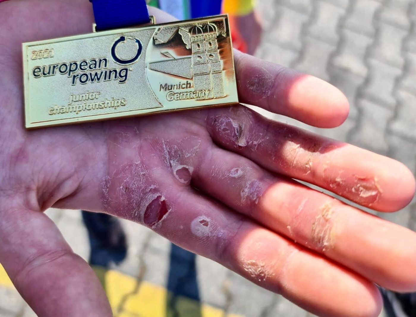 Cum arată palmele de aur ale unei campioane europene la canotaj! Mesajul emoționant al ieșencei Cosmina Dram: „Fiecare rană, fiecare lacrimă, pe toate le-am uitat când am auzit imnul”