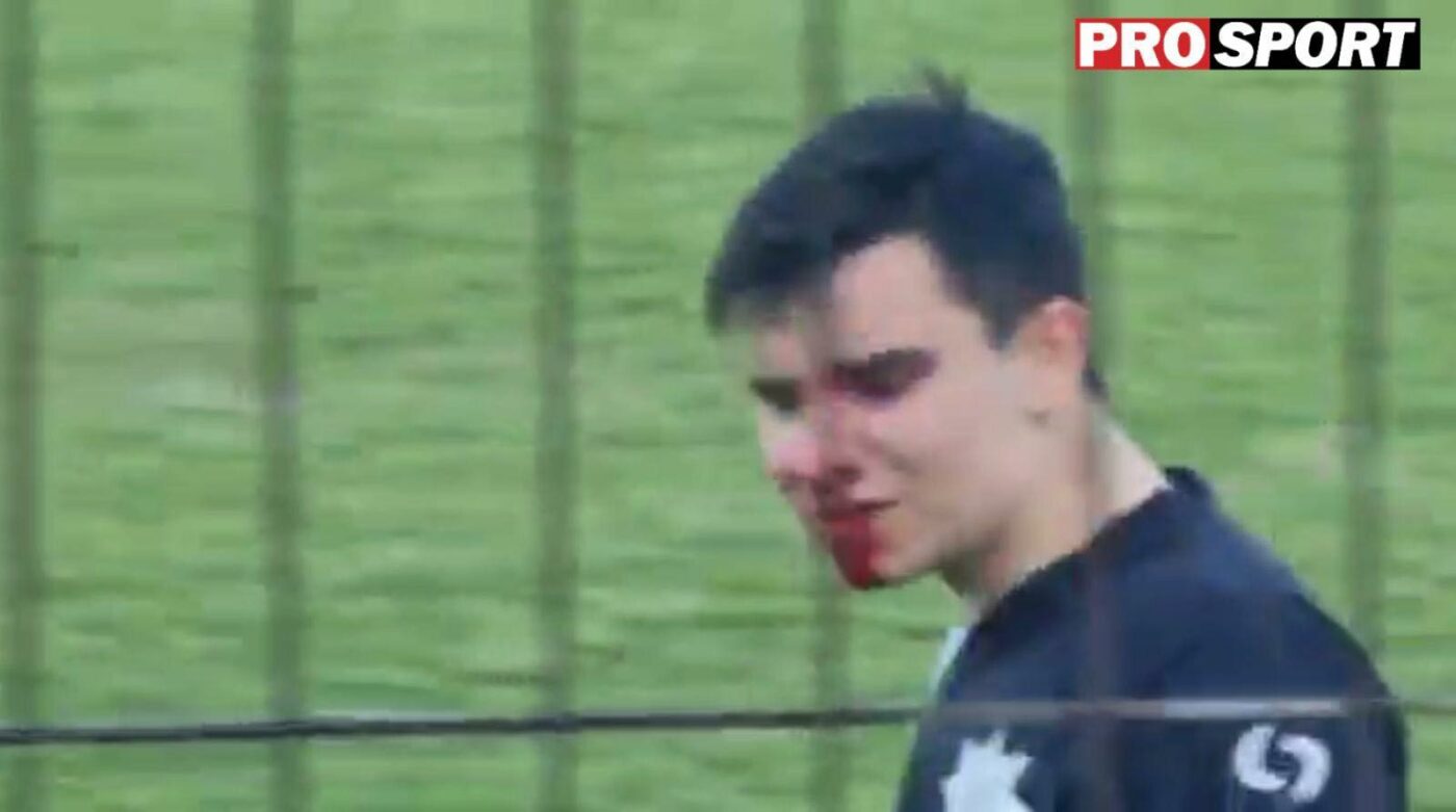 Scene șocante în fotbalul românesc! Jucătorii s-au bătut până la sânge la derby-ul pentru promovare | VIDEO