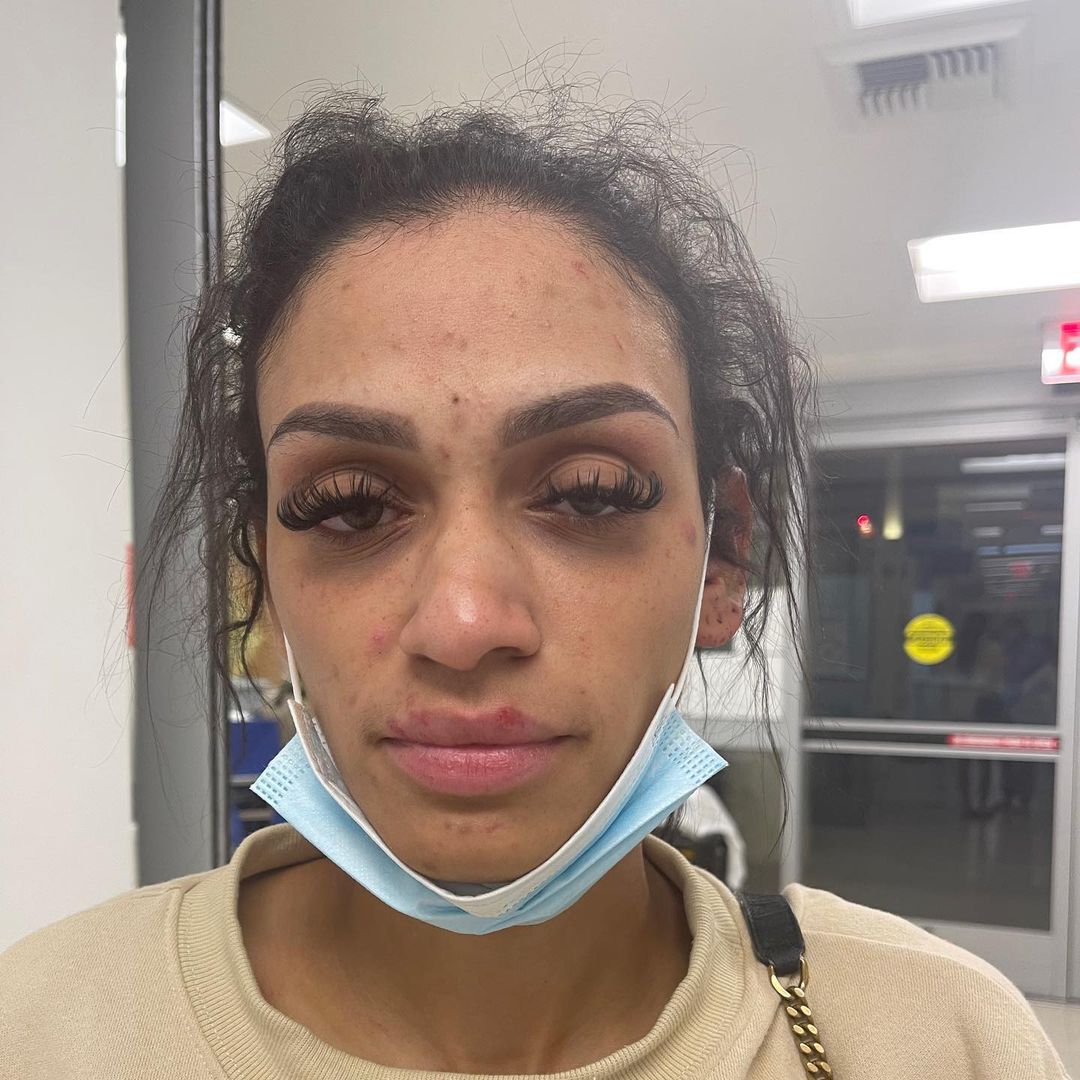 Soția celebrului sportiv, mărturii cutremurătoare: „M-a abuzat în toate modurile! Copiii au fost martori!” .E șocant ce scrie pe raportul medico-legal: atac prin strangulare, comoție cerebrală, fractură nazală!