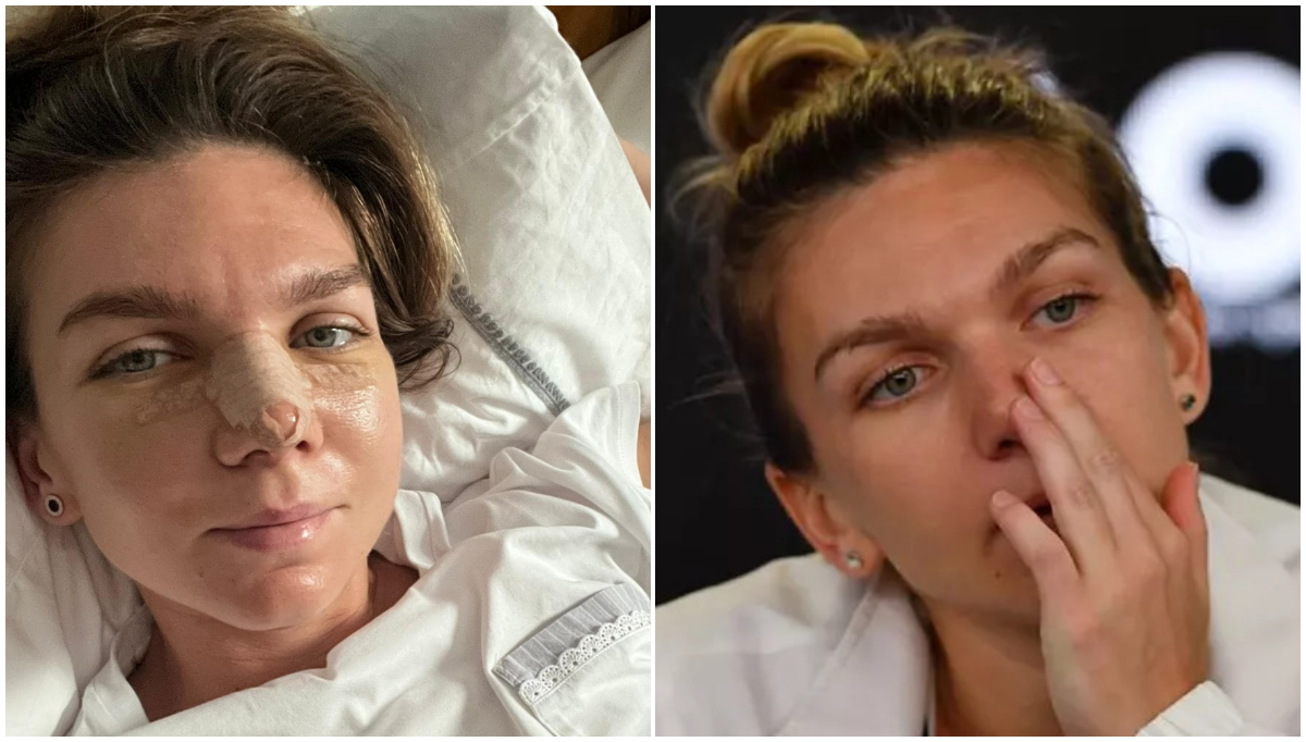 Simona Halep a ajuns în cel mai cunoscut tabloid din SUA după ce și-a operat nasul: „Va arăta diferit pe terenul de tenis!” Ce au remarcat americanii la româncă