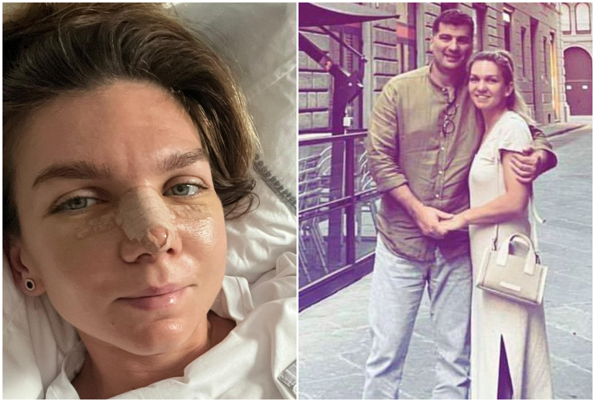 Simona Halep a spus tot adevărul! De ce și-a făcut rinoplastie chiar după divorț și motivul pentru care și-a modificat forma nasului: „Nu-mi plăcea deloc!” FOTO