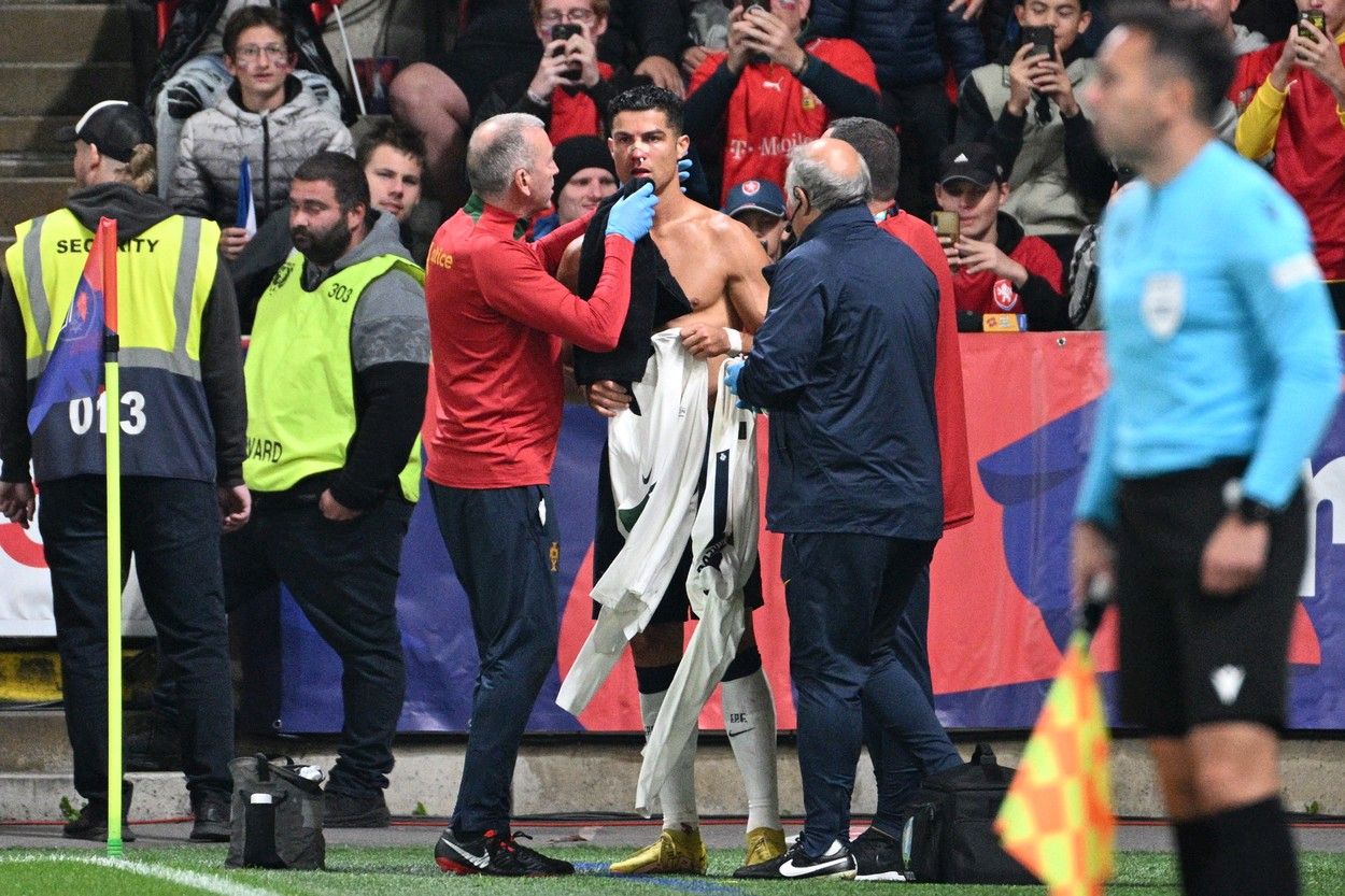 Momente de groază trăite de Cristiano Ronaldo. Portughezul a fost umplut de sânge și a avut nevoie de îngrijiri medicale