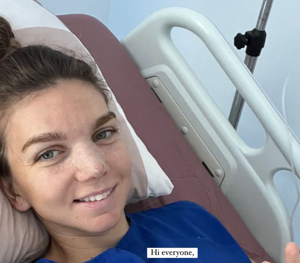 Simona Halep şi-a făcut o operație estetică după divorțul de Toni Iuruc! Anunțul făcut de jucătoare despre intervenția chirurgicală: „Câteva săptămâni nu am voie să fac activități fizice”