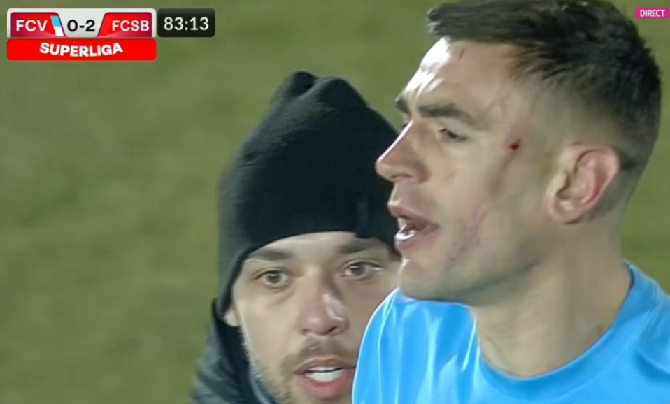Eroare gravă de arbitraj în favoarea FCSB! Malcom Edjouma și-a desfigurat adversarul. „Un fault grosolan! Trebuia să dea cartonaș roșu!” Cum arată fundașul lui FC Voluntari | FOTO
