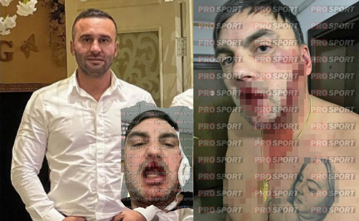 Imagini cutremurătoare, cu un puternic impact emoțional! La un pas de o altă tragedie, la 14 ani de la moartea lui Marian Cozma: un fost handbalist a fost tăiat, la Constanța, într-o răfuială! | FOTO EXCLUSIV