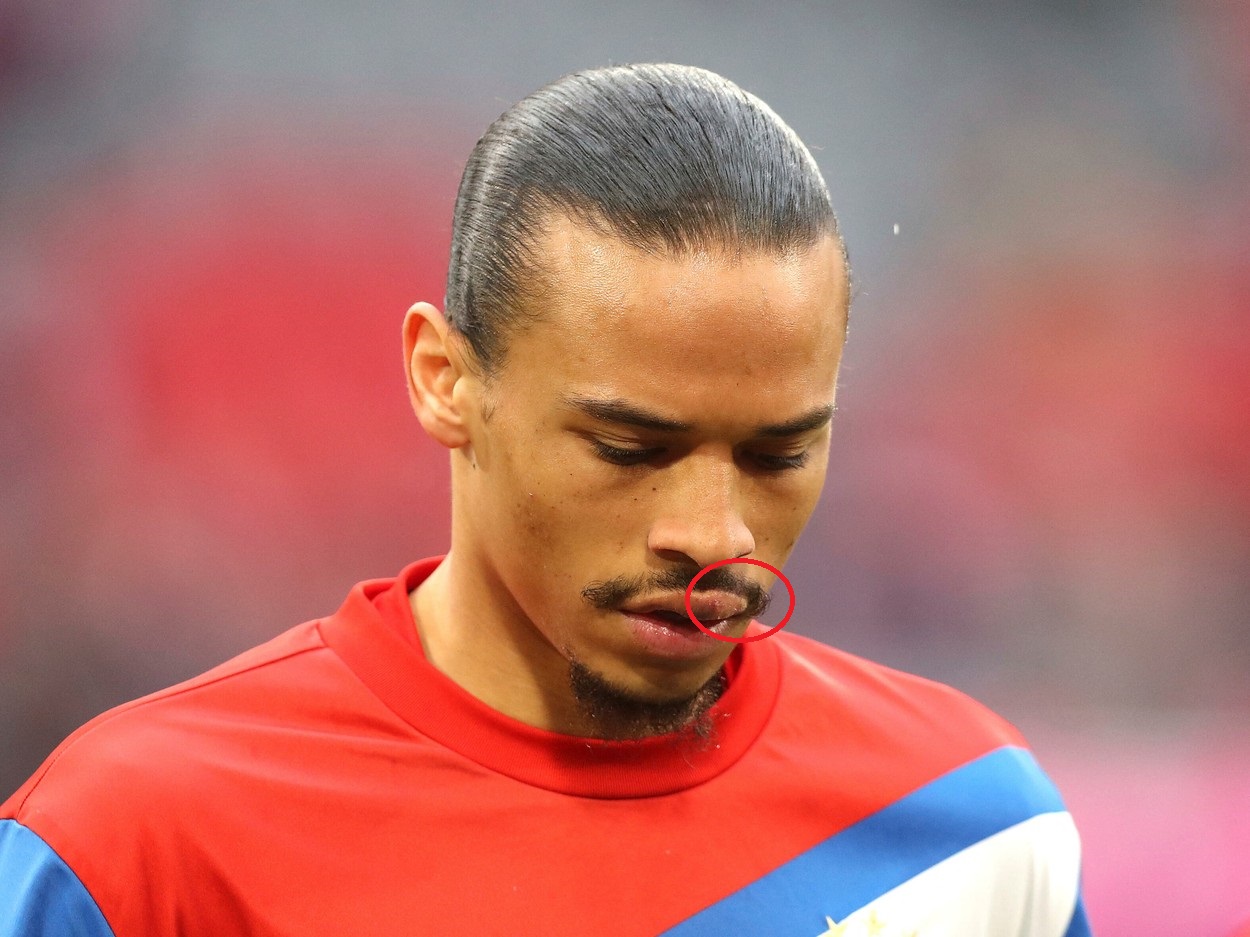 Cum arată Leroy Sane după ce a fost bătut de Sadio Mane în vestiarul lui Bayern! Prima apariție a neamțului | FOTO