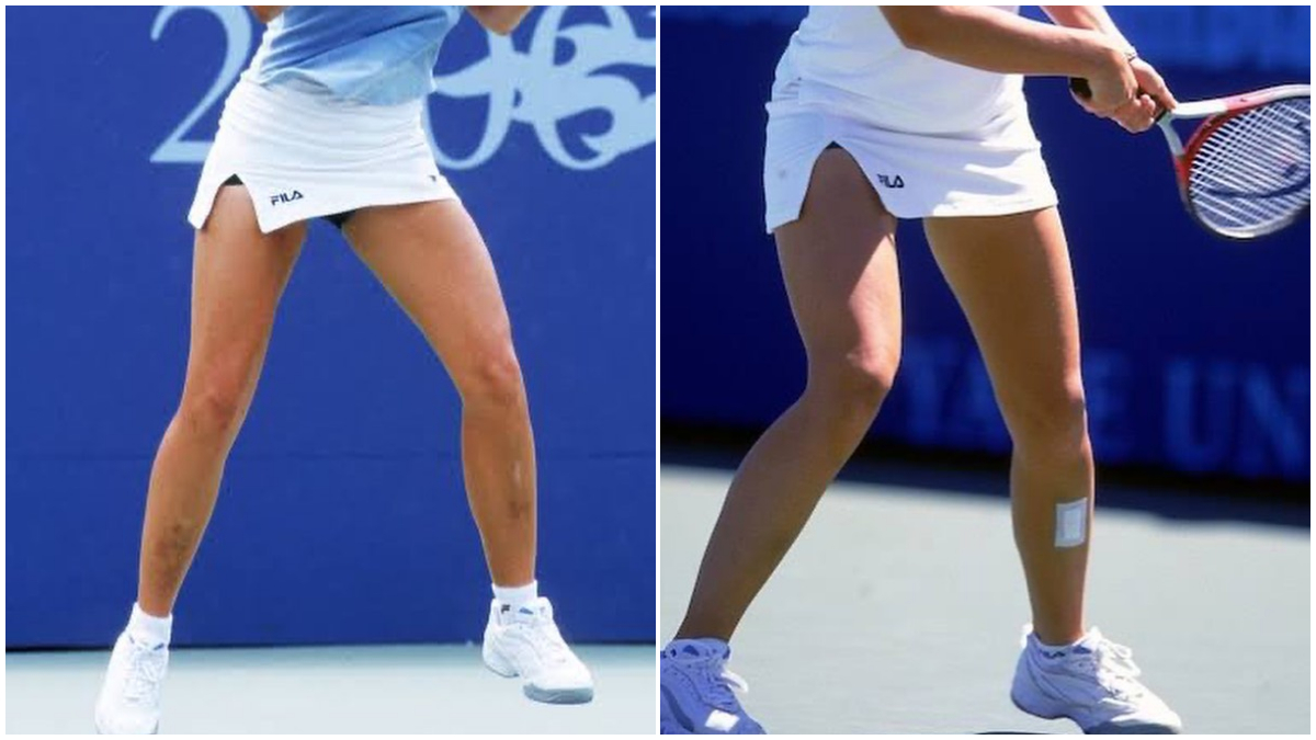 Moment șocant în tenis: o jucătoare cunoscută a intrat pe teren cu urme grave de bătaie pe corp! „Am fost lovită toată noaptea pentru că am pierdut un meci!” FOTO