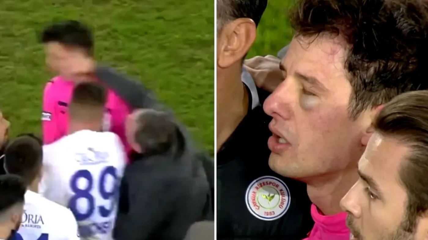 Ce i-a strigat bașkanul bătăuș arbitrului pe care l-a lovit chiar în fața celorlalți oameni din brigadă! Îi face plângere penală: „Niciun compromis”