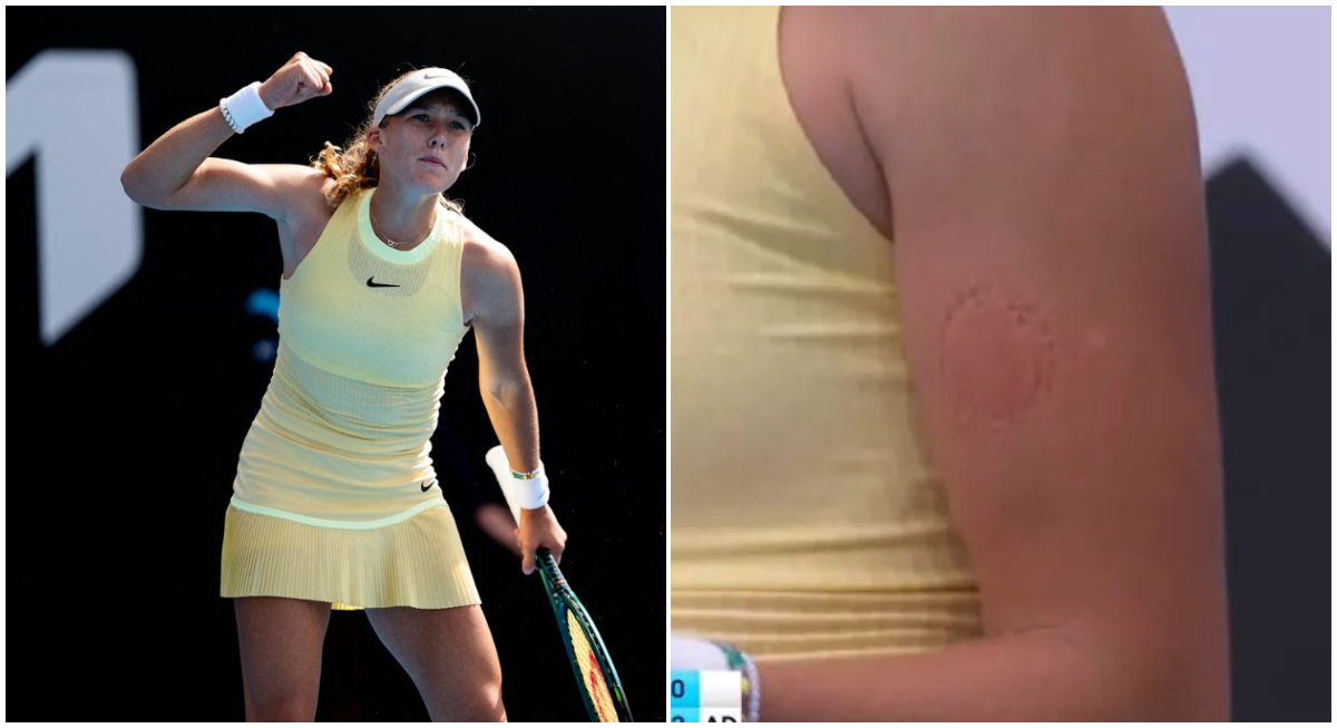 Gesturi șocante ale puștoaicei de 16 ani care face furori la Australian Open: s-a mușcat singură, în timpul meciului. FOTO
