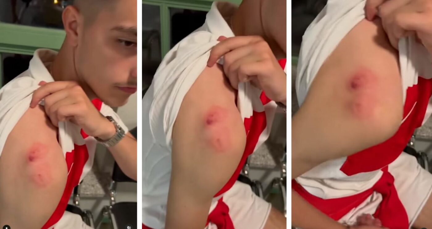 Poliția din Germania a dat-o în urmărire pe femeia care l-a mușcat pe un fan! Totul s-a petrecut în timpul unei bătăi de la EURO când atacantul și-a aruncat tricoul în tribună!