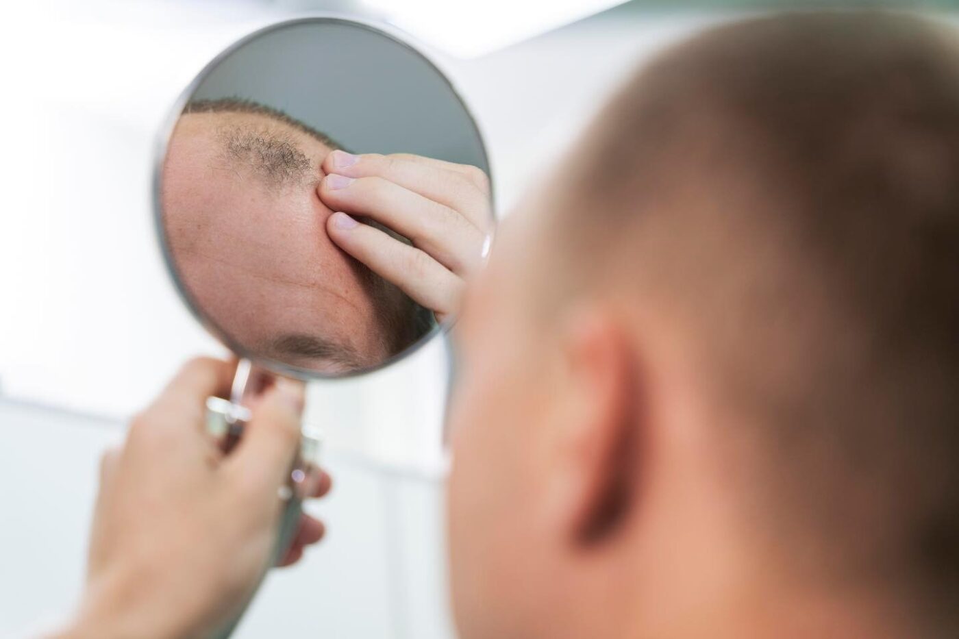 (P) Implant de păr avansat prin tehnica Q-FUE. Mai mult decât o simplă procedură – o transformare!