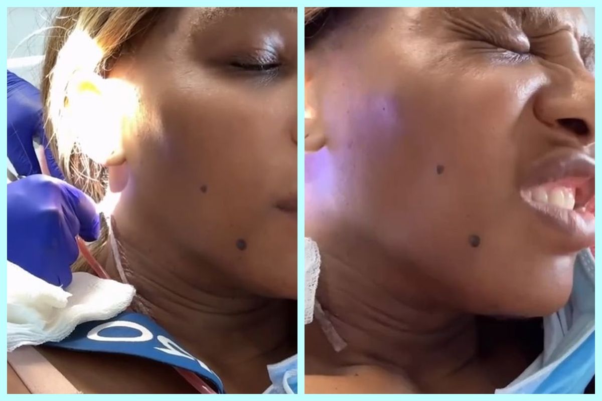 Serena Williams a avut un chist de „mărimea unui grapefruit” îndepărtat din zona gâtului