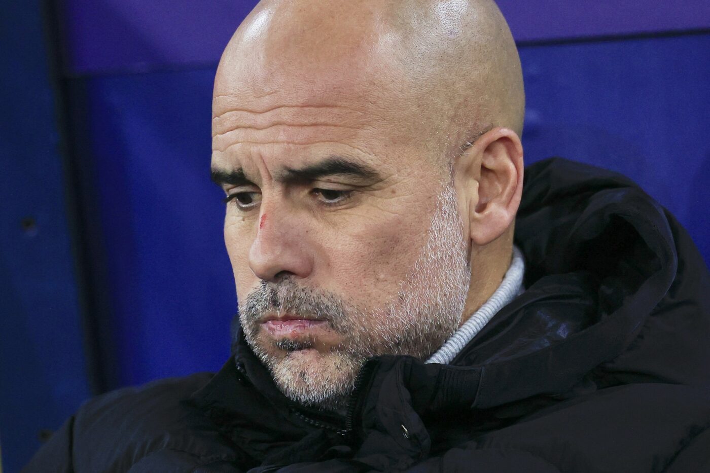 Pep Guardiola a apărut plin de zgârieturi și cu sânge pe față la conferința de presă, după Manchester City – Feyenoord 3-3! Ce explicații le-a dat jurnaliștilor