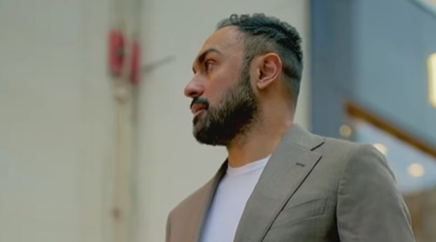 Încă un fotbalist a decis să-și facă transplant de păr: „Am vrut să-mi cresc încrederea în mine”
