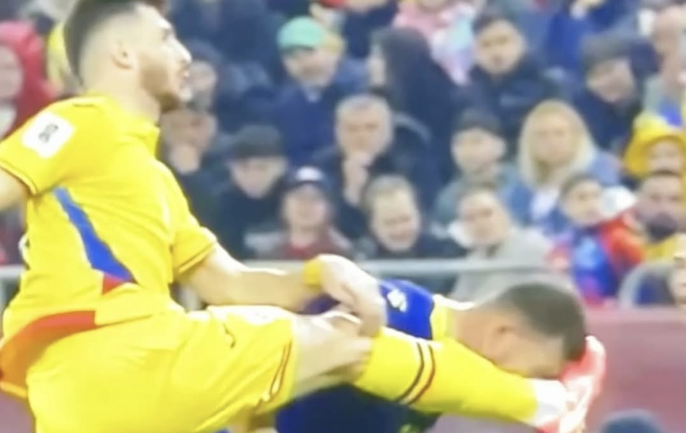 Fotbalistul lui Dan Șucu a reacționat și i-a scris lui Edin Dzeko, după ce a văzut cum l-a desfigurat Mihai Popescu