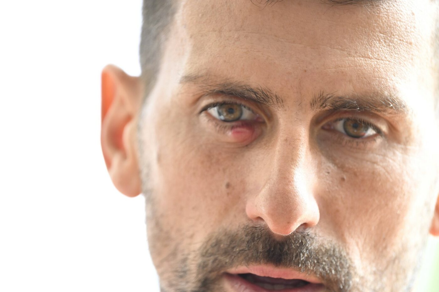 Novak Djokovic a vorbit despre misterul ochiului său umflat